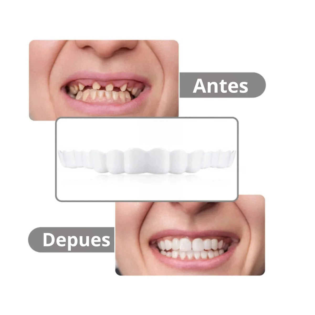 Sonrisa Mágica™ Tu nueva sonrisa en minutos