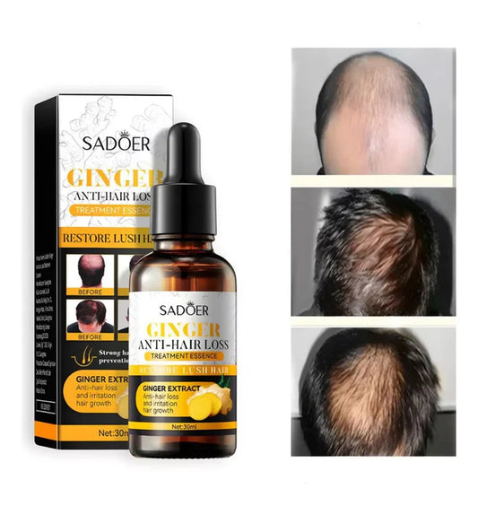 Sadoer Ginger™ Serum Capilar Anticaída de Jengibre