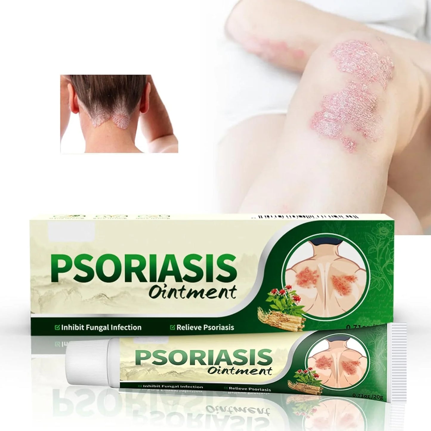 Crema Psoriasis™ Cuidado Intensivo para Piel Sensible y con Irritaciones