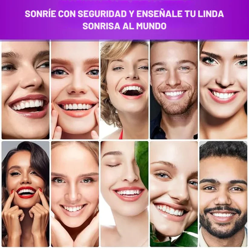 Hismile V34™ Luce una sonrisa más blanca al instante