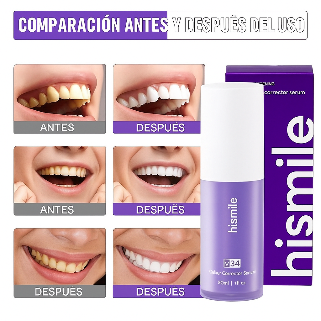 Hismile V34™ Luce una sonrisa más blanca al instante