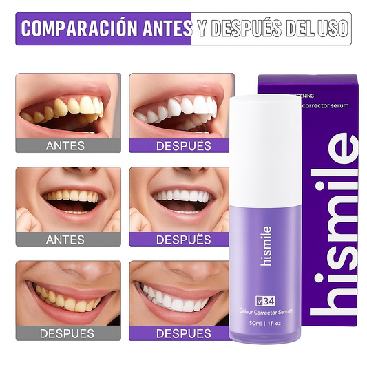 Hismile V34™ Luce una sonrisa más blanca al instante